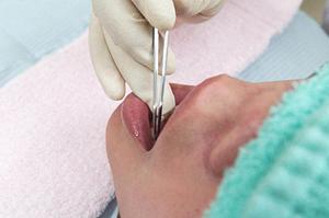 千葉市で顎関節症の治療が出来る歯医者