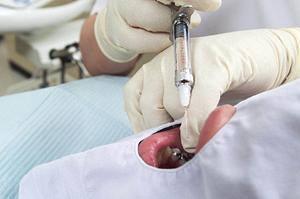 クレアチニン値と健康診断結果の解説 – 信頼性の高い情報を提供