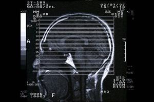 大分で最先端のインプラントをするなら