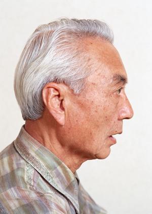 金沢市で白内障の治療を受けましょう